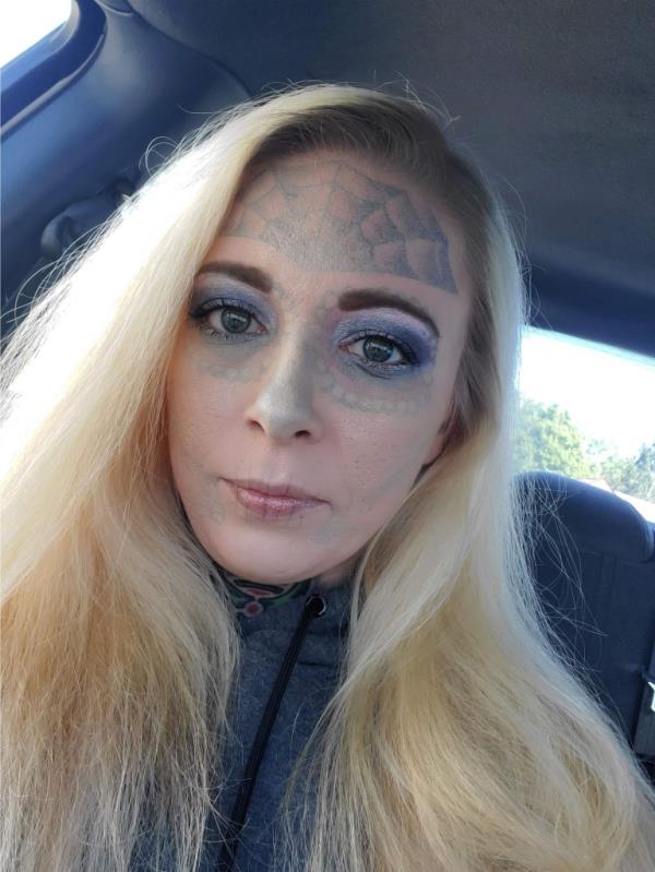 Alyssa Zebrasky is pictured after undergoing multiple sessions to laser off her macabre face tattoos, some of which are still visible. 