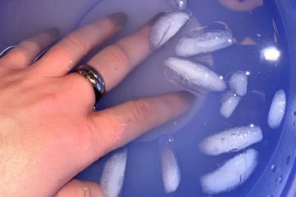 I forgot to remove a ring before bedtime — it turned into a real horror story