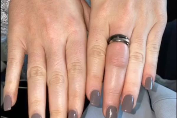 I forgot to remove a ring before bedtime — it turned into a real horror story